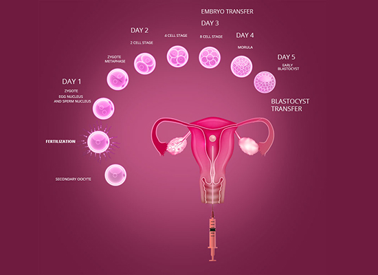 Blastocyst Transfer
