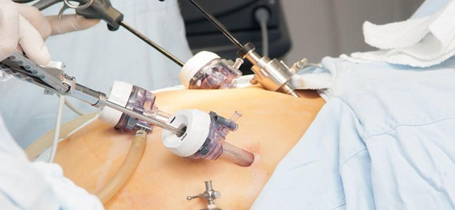 FELLOWSHIP IN GYNEC LAPAROSCOPY