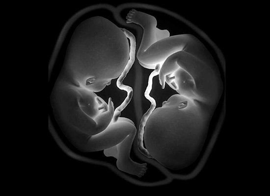 High Risk Pregnancy Care