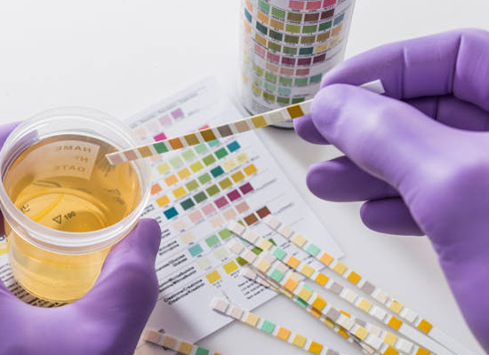 Post Ejaculation Urine Analysis