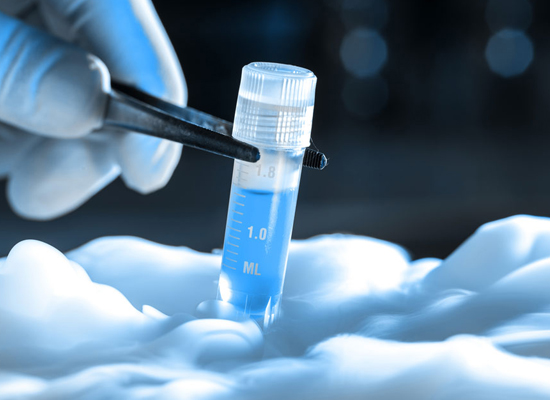 Semen Freezing